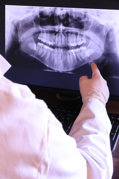 Best Emergency Treatment for Oral Infections in Shrewsbury, MO
