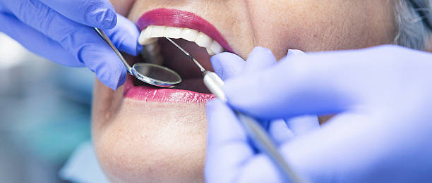 Best Emergency Cosmetic Dentistry (e.g., broken veneers) in Shrewsbury, MO